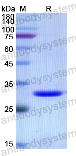 Recombinant Human KLC1 Protein, N-His