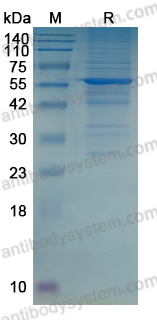Recombinant Human SOS2 Protein, N-His