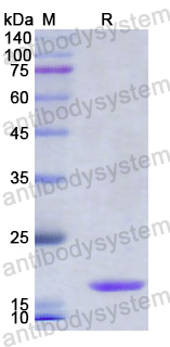 Recombinant Human FOXM1 Protein, N-His
