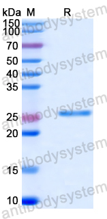 Recombinant Human DHX9 Protein, N-His