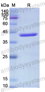 Recombinant Human GM130/GOLGA2 Protein, N-His