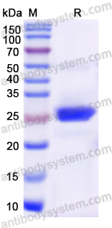 Recombinant Human LOXL1 Protein, N-His