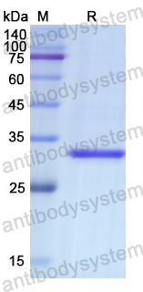 Recombinant Human DMTN Protein, N-His