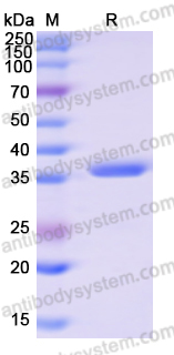 Recombinant Human PDE4D Protein, N-His