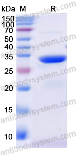 Recombinant Human DSC1 Protein, N-His
