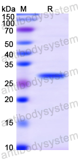 Recombinant Human ADCY1 Protein, N-His