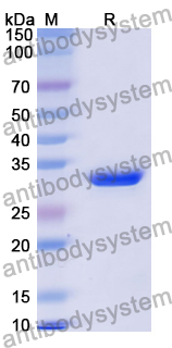Recombinant Human ADCY1 Protein, N-His