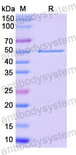 Recombinant Human SSRP1 Protein, N-His