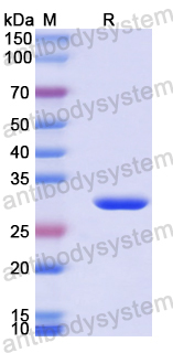 Recombinant Human NCBP1 Protein, N-His