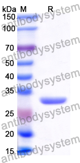 Recombinant Human EP300 Protein, N-His