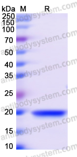 Recombinant Human LMOD3 Protein, N-His