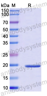 Recombinant Human TROAP Protein, N-His-SUMO