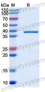 Recombinant Human KIF5A Protein, N-His