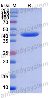Recombinant Human TP53BP1 Protein, N-His