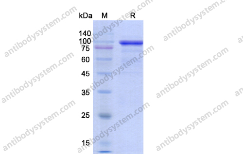 Recombinant Human TP53BP1 Protein, N-His-GFP