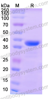 Recombinant Human CD148/PTPRJ Protein, N-His