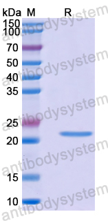 Recombinant Human FOXC1 Protein, N-His-SUMO