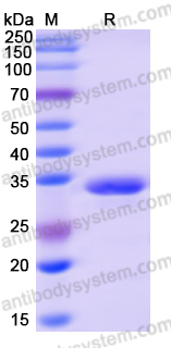 Recombinant Human NFATC3 Protein, N-His