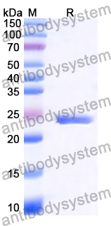 Recombinant Human TRIM32 Protein, N-His-SUMO & C-Strep