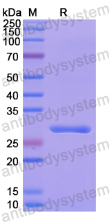 Recombinant Human NAIP Protein, N-His