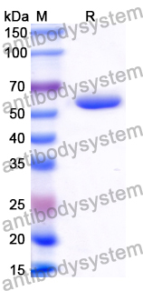 Recombinant Human ACACA Protein, N-His