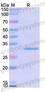Recombinant Human IFT88 Protein, N-His