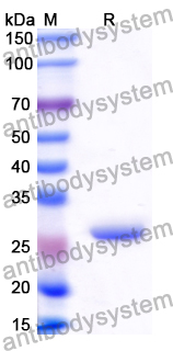 Recombinant Human USP4 Protein, N-His