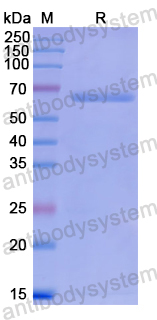 Recombinant Human PRKAA1/AMPK alpha 1 Protein, N-His