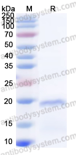 Recombinant Human TDP43 Protein, N-His