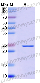 Recombinant Human AIMP2 Protein, N-His