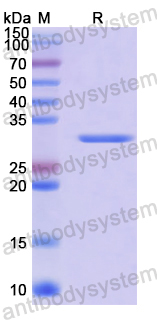 Recombinant Human STK3 Protein, N-His
