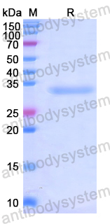 Recombinant Human CHIT1 Protein, N-His