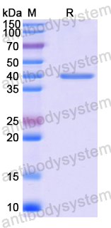 Recombinant Human PRKG2 Protein, N-His