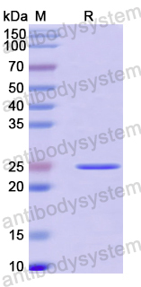 Recombinant Human MAD2L1 Protein, N-His