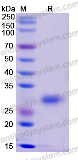 Recombinant Human TRIM28 Protein, N-His-SUMO & C-Strep