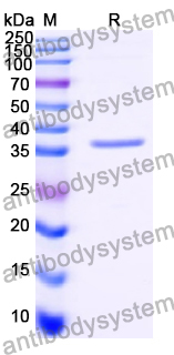 Recombinant Human TRIM28 Protein, N-His