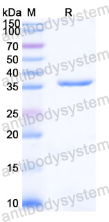 Recombinant Human CLN3 Protein, N-GST & C-His