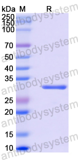 Recombinant Human GPR17 Protein, N-GST & C-His