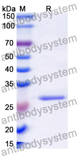 Recombinant Human GPR17 Protein, N-His-KSI