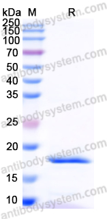 Recombinant Human ATM Protein, N-His
