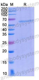 Recombinant Human IFIT5 Protein, N-His