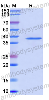 Recombinant Human CTBP1 Protein, N-His