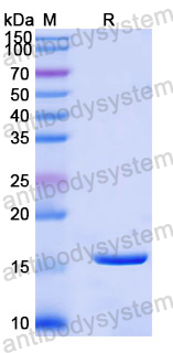 Recombinant Human IKZF1 Protein, N-His