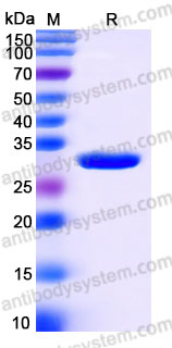 Recombinant Human NNT Protein, N-His