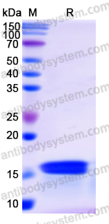 Recombinant Human XRCC4 Protein, N-His