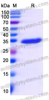 Recombinant Human TCOF1 Protein, N-GST & C-His