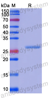 Recombinant Human OS9 Protein, N-His