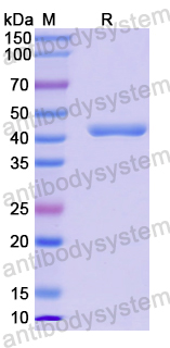 Recombinant Human ROCK1 Protein, N-His