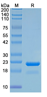 Recombinant Human ROCK1 Protein, C-His