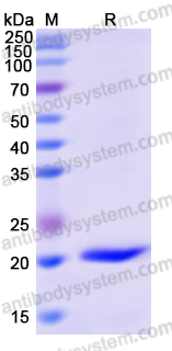 Recombinant Human NFATC2 Protein, N-His